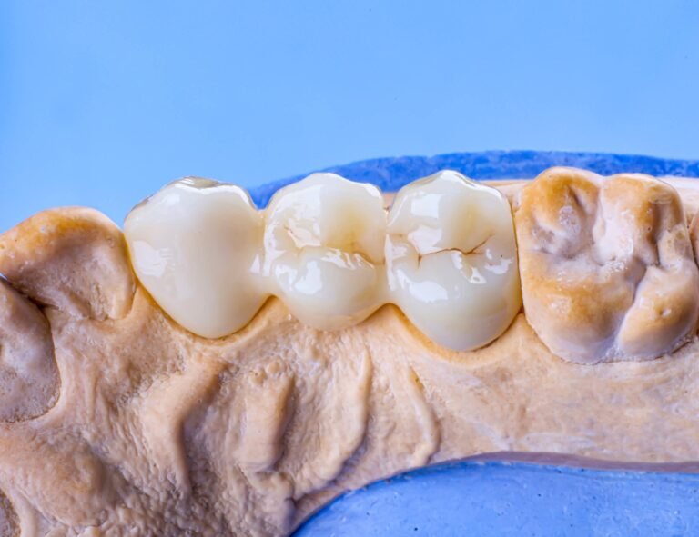 Best Dental Treatment in Shalimar Gdns Ext