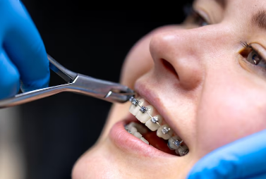 Expert Dentist Treatment in Ghaziabad