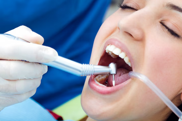 Best Cavity Treatment in Ghaziabad